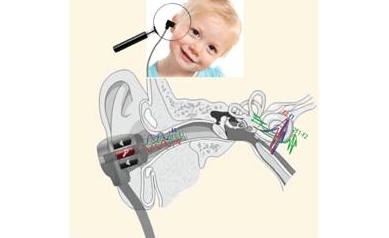 Hearing Test May Identify Autism Risk