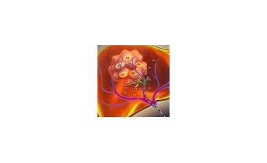 Researchers Look to Improve Late-Stage Liver Cancer Therapy