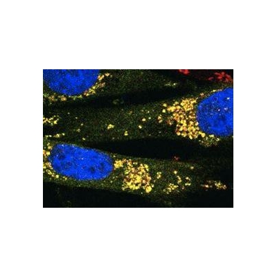 Wilmot Scientists Exploit Cell Metabolism to Attack Cancer