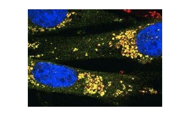 Wilmot Scientists Exploit Cell Metabolism to Attack Cancer