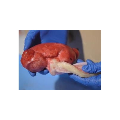 Creating the “Model Human” to Practice Surgery
