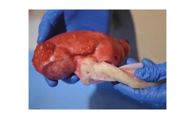 Creating the “Model Human” to Practice Surgery