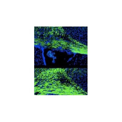 Repurposed Drugs May Offer Improved Treatments for Fatal Genetic Disorders