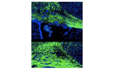 Repurposed Drugs May Offer Improved Treatments for Fatal Genetic Disorders