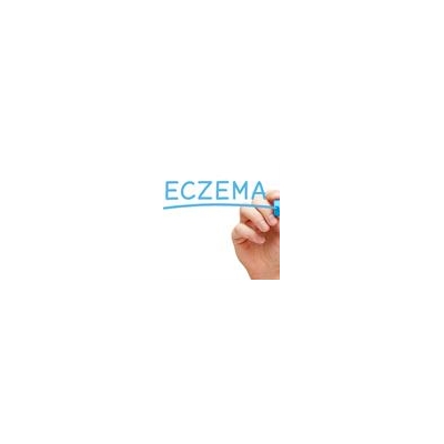 FDA Approves New Eczema Drug Tested at URMC