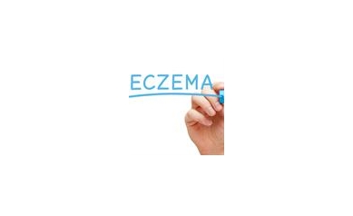 FDA Approves New Eczema Drug Tested at URMC