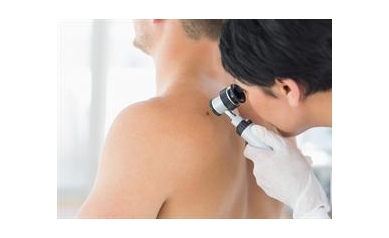 UR Medicine Offers Free Skin Cancer Screening May 20