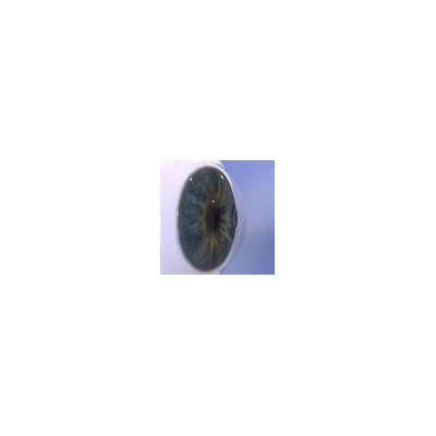 UR Medicine’s Flaum Eye Institute First in Region to Offer Procedure for Near Vision Loss
