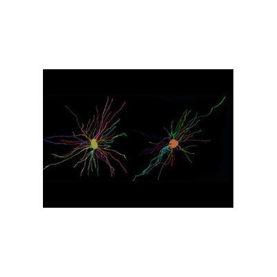 Faulty Support Cells Disrupt Communication in Brains of People with Schizophrenia