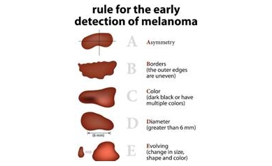 Research is Changing the Game for Melanoma Treatment