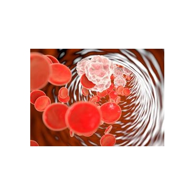 Lungs Mays Hold Key to Thwarting Brain Damage after a Stroke
