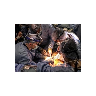 New LVAD Heart Pump Surgery is Minimally Invasive and Led by UR Medicine