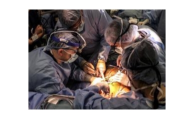 New LVAD Heart Pump Surgery is Minimally Invasive and Led by UR Medicine