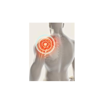 Common Painkiller Not Effective for Traumatic Nerve Injury