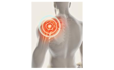 Common Painkiller Not Effective for Traumatic Nerve Injury