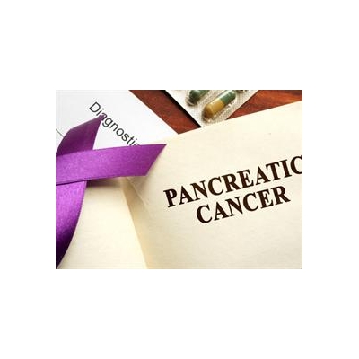 Scientists Uncover Valuable Gene Activity for Precancerous Cysts, Cancer in Pancreas