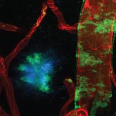 Study Points to New Method to Deliver Drugs to the Brain