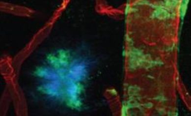Study Points to New Method to Deliver Drugs to the Brain