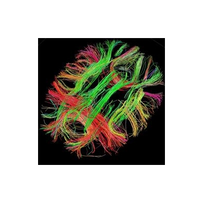 New Research Initiative to Focus on Cerebrovascular Diseases