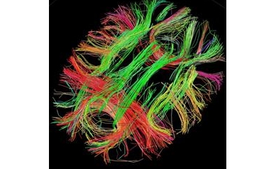 New Research Initiative to Focus on Cerebrovascular Diseases
