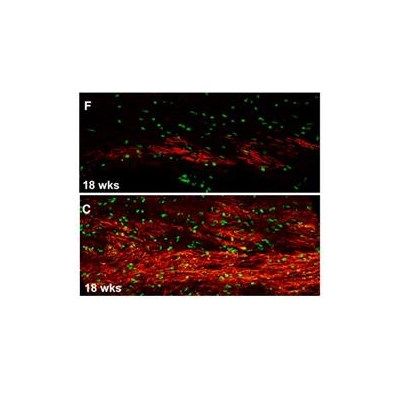 Study Confirms Central Role of Brain’s Support Cells in Huntington’s, Points to New Therapies