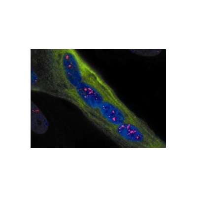 Grant Marks Two Decades of NIH Support for Muscular Dystrophy Research