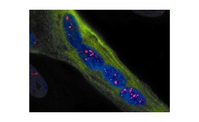 Grant Marks Two Decades of NIH Support for Muscular Dystrophy Research