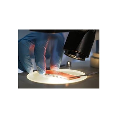 Researchers Aim to Keep Blood Healthier, Less Prone to Cancer