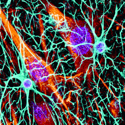 New Funding Boosts URMC Biotech Start-Up for Neurological Disorders
