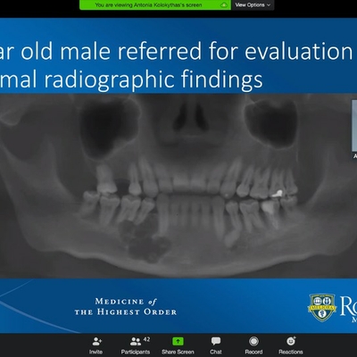 OMFS International Grand Rounds a First at URMC