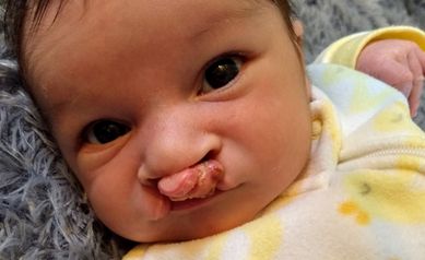 Drive By Dentistry During COVID 19 Helps Infant