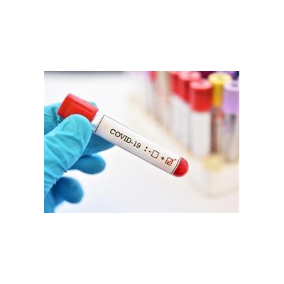 New URMC Coronavirus Research Examines Immune Response