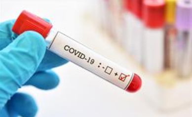 New URMC Coronavirus Research Examines Immune Response