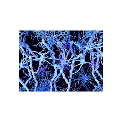 Animal Study Shows Human Brain Cells Repair Damage in Multiple Sclerosis