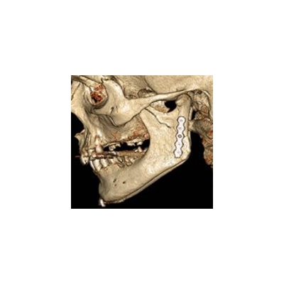 Oral &Maxillofacial Surgery Adds Two Programs