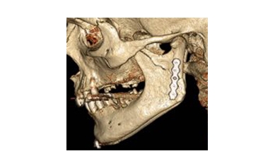 Oral &Maxillofacial Surgery Adds Two Programs