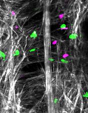 Immune cells imaged in the skin