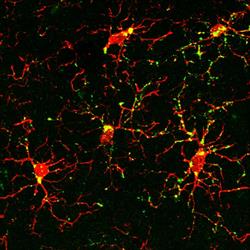 Image from study shows protein marker (green) that indicates activation of microglia (red) after exp