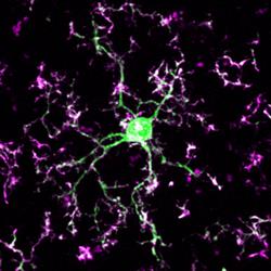 Immune Cells Rewire, Repair Brain While We Sleep