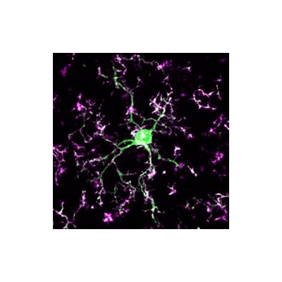 The Night Gardeners -- Immune Cells Rewire, Repair Brain While We Sleep