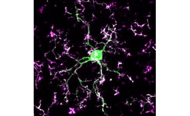 The Night Gardeners -- Immune Cells Rewire, Repair Brain While We Sleep