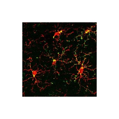 Radiation Breaks Connections in the Brain