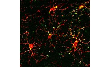 Radiation Breaks Connections in the Brain