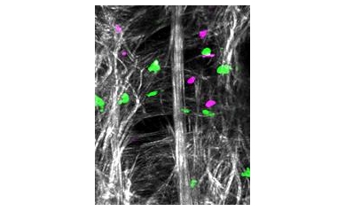 Rochester Researchers Receive $12 Million Award to Visualize the Immune System in Action