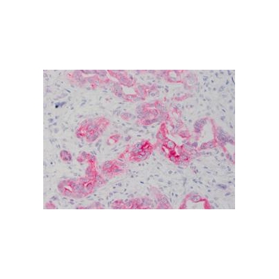 Wilmot Researchers Create New Way to Study Liver Cancer