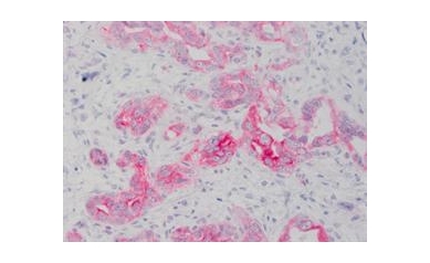 Wilmot Researchers Create New Way to Study Liver Cancer