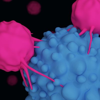 Sometimes Tumors Vanish, but Improvements Still Needed for CAR T-Cell Immunotherapy