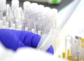 Antibody Lab Photo