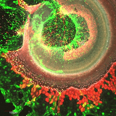 Study Points to Possible New Therapy for Hearing Loss