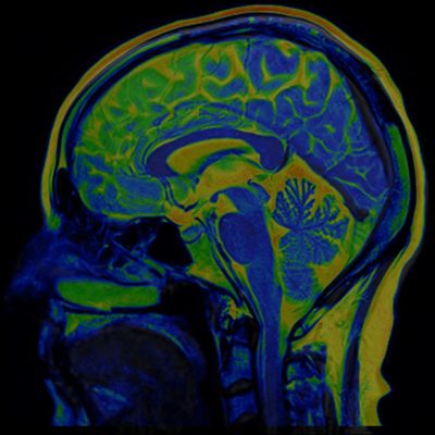 Anxiety cues found in the brain despite safe environment